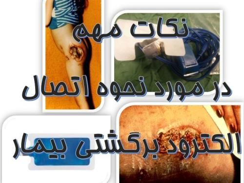 نکات مهم در مورد اتصال پلیت به بیمار